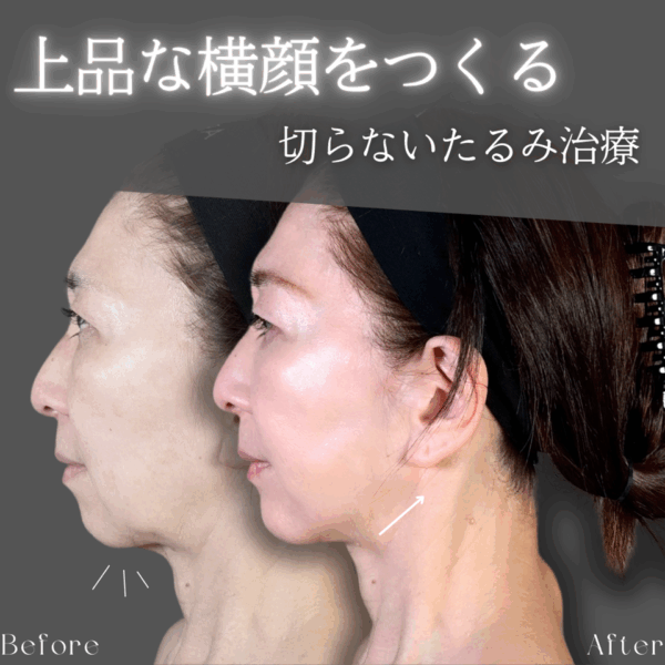 No.9026の症例写真